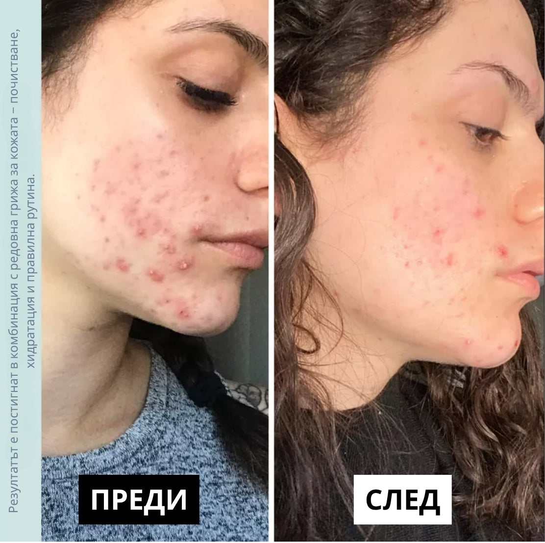 Laurel Derma